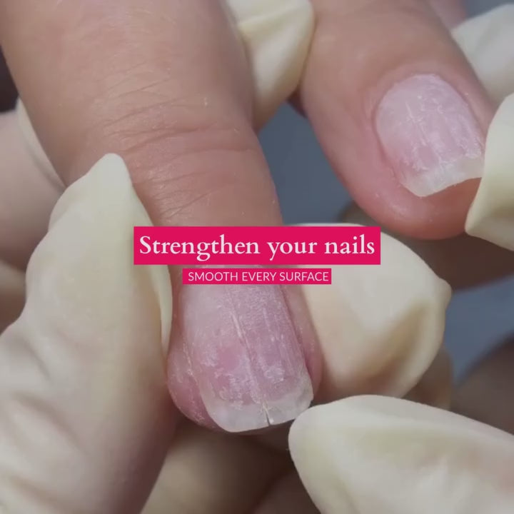 Nail Repair Kit